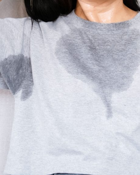 ACS - Excessive Sweating